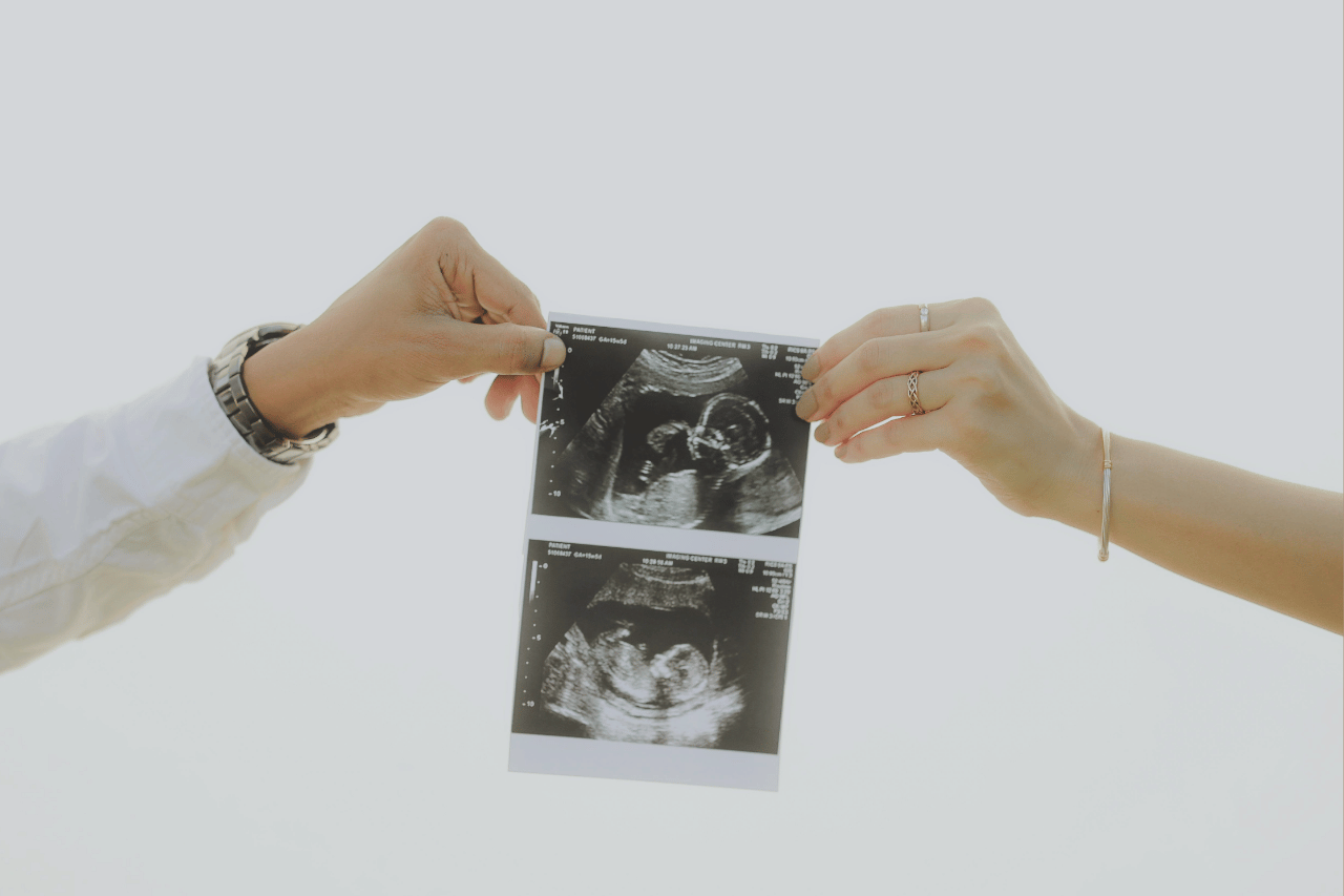 Imagen que representa el fuero de paternidad en Colombia con una ecografía sostenida por dos personas. Russell Bedford.